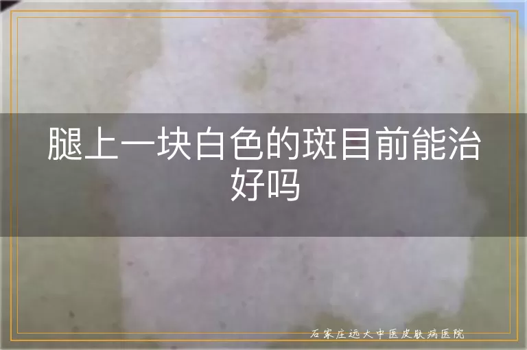 腿上一块白色的斑目前能治好吗