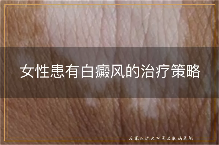 女性患有白癜风的治疗策略