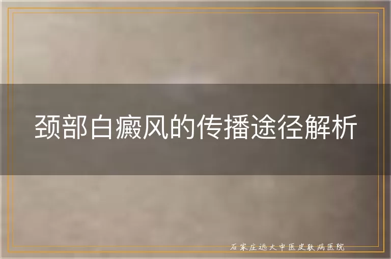 颈部白癜风的传播途径解析
