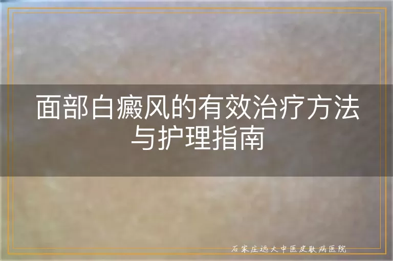面部白癜风的有效治疗方法与护理指南