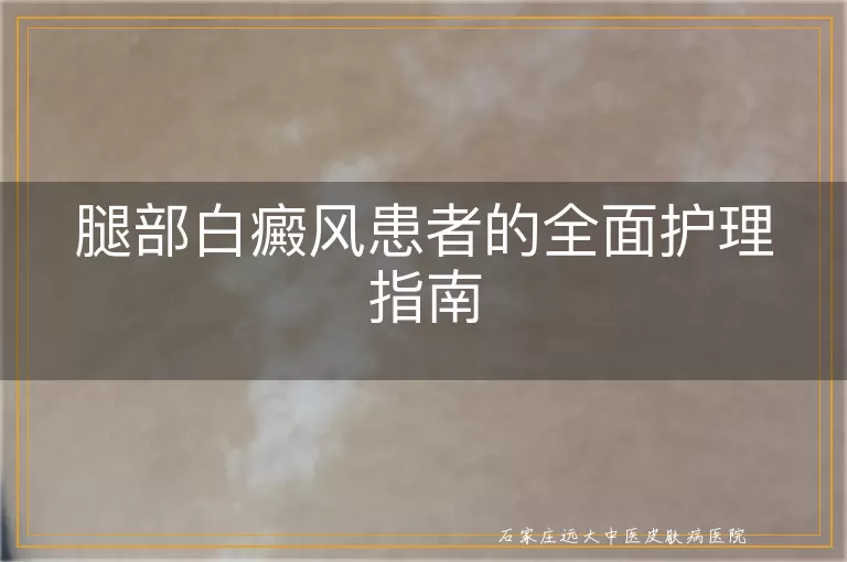 腿部白癜风患者的全面护理指南