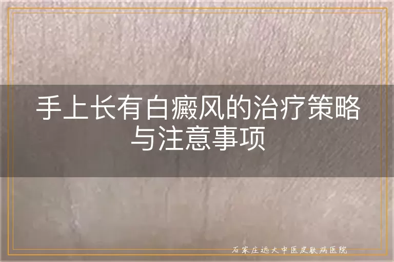 手上长有白癜风的治疗策略与注意事项