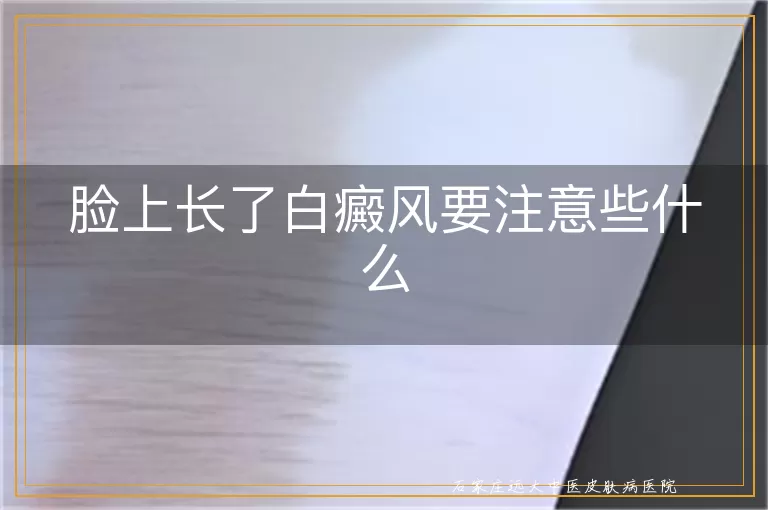 脸上长了白癜风要注意些什么