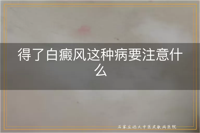 得了白癜风这种病要注意什么