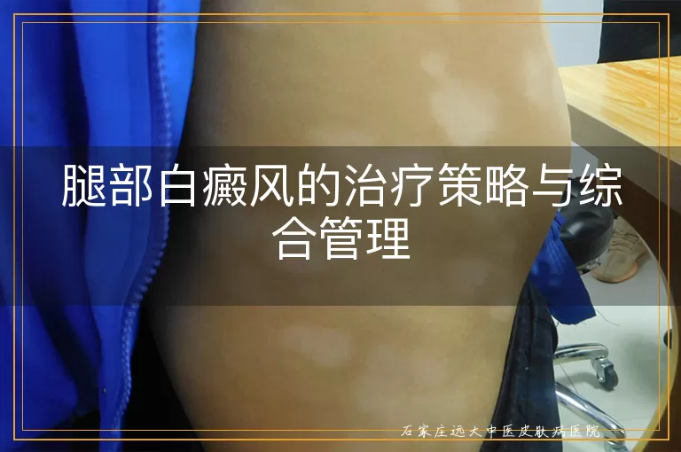 腿部白癜风的治疗策略与综合管理