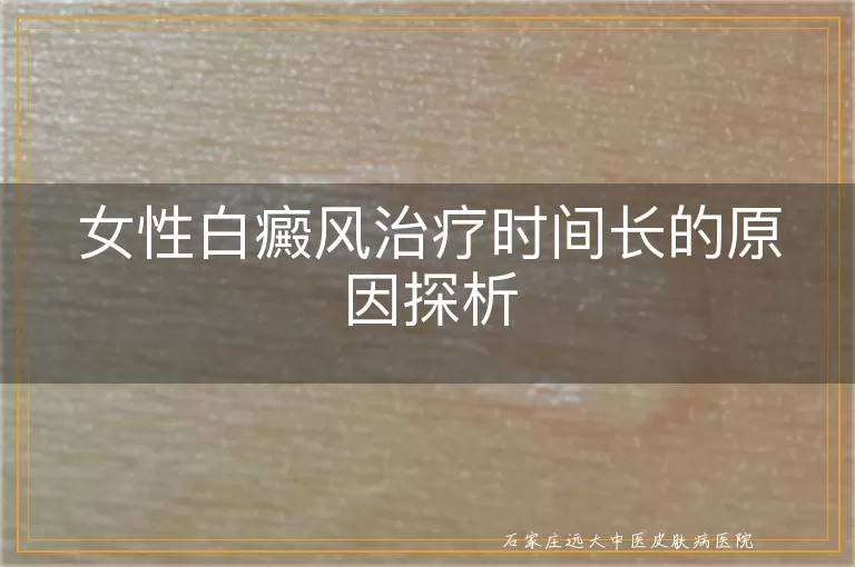 女性白癜风治疗时间长的原因探析