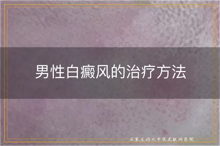 男性白癜风的治疗方法