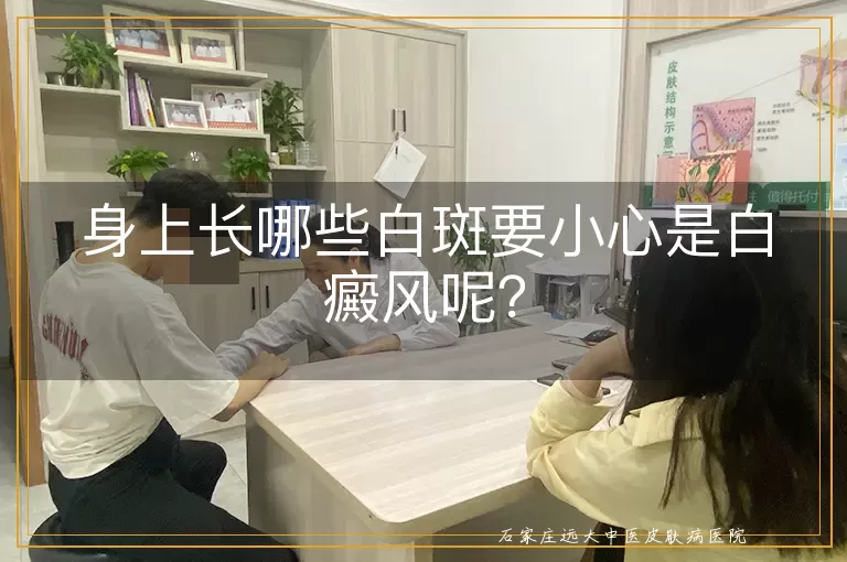 身上长哪些白斑要小心是白癜风呢？