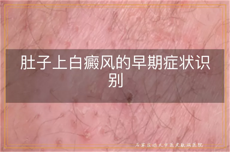 肚子上白癜风的早期症状识别