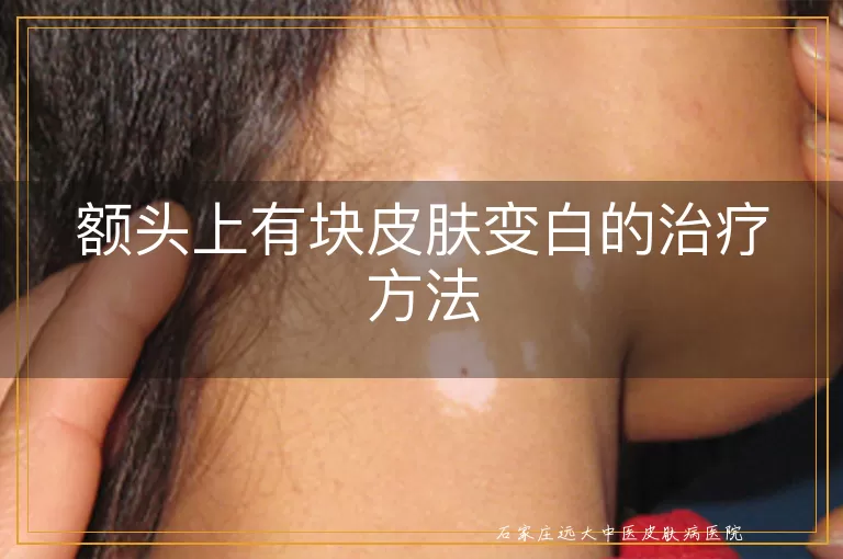 额头上有块皮肤变白的治疗方法