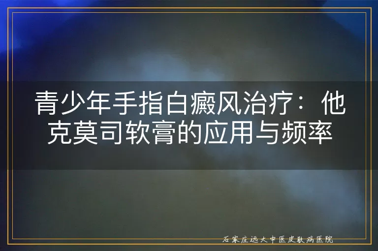 青少年手指白癜风治疗：他克莫司软膏的应用与频率