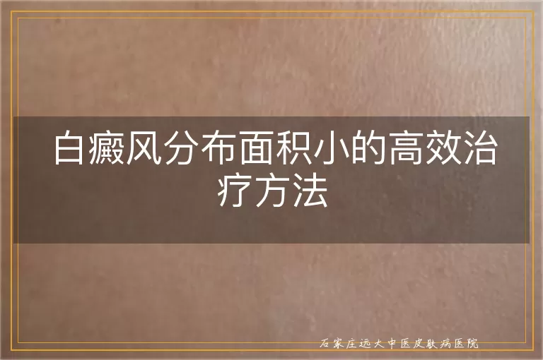 白癜风分布面积小的高效治疗方法
