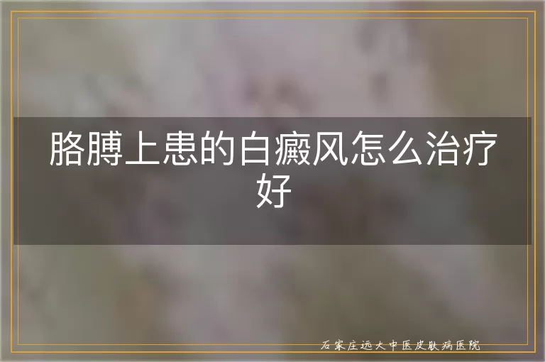 胳膊上患的白癜风怎么治疗好