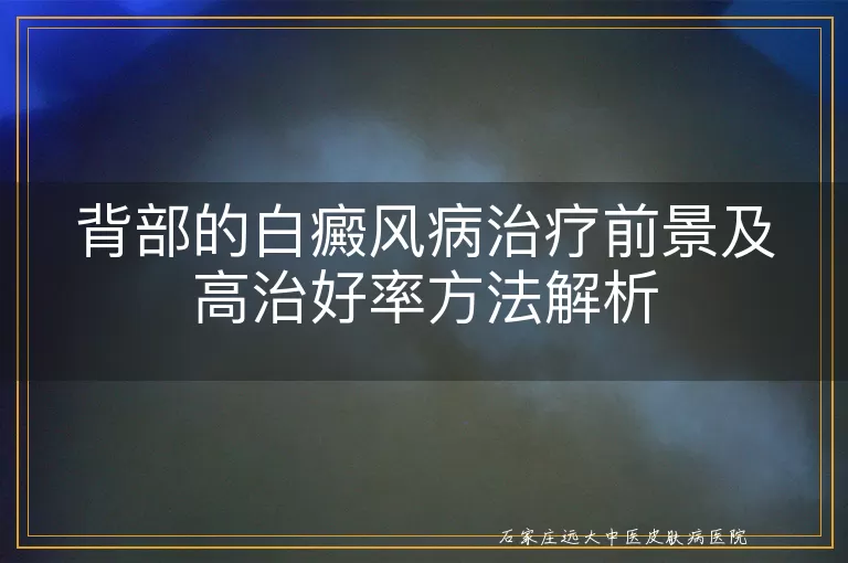 背部的白癜风病治疗前景及高治好率方法解析