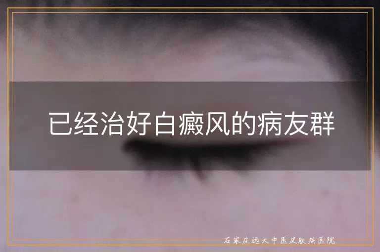 已经治好白癜风的病友群