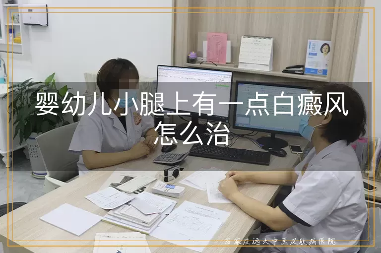 婴幼儿小腿上有一点白癜风怎么治