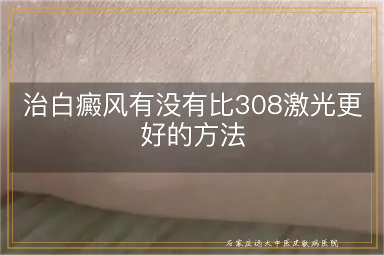 治白癜风有没有比308激光更好的方法