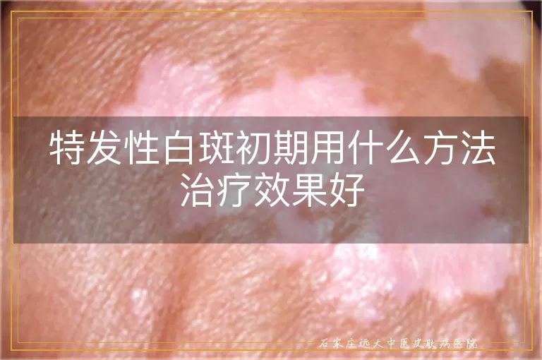 特发性白斑初期用什么方法治疗效果好