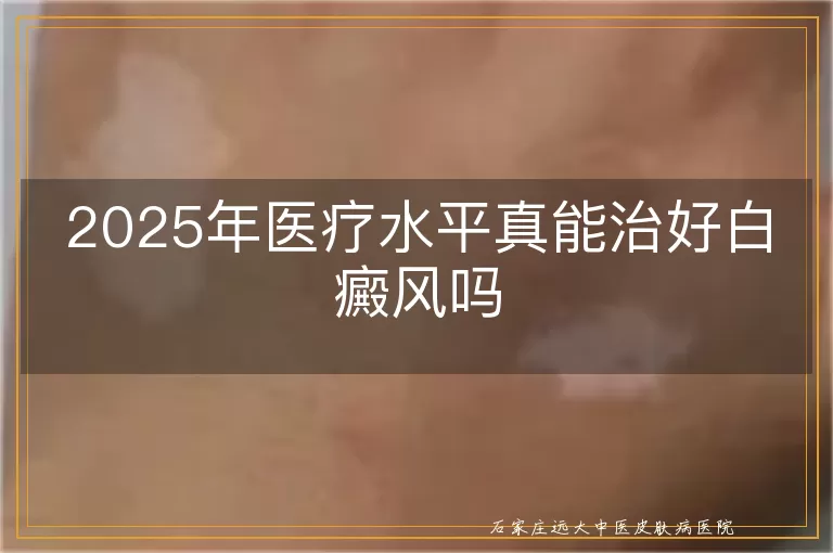 2025年医疗水平真能治好白癜风吗