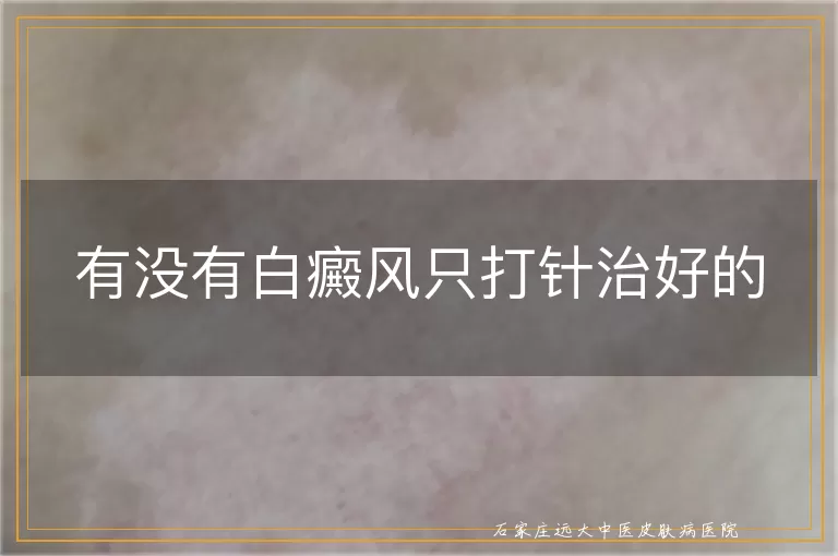 有没有白癜风只打针治好的