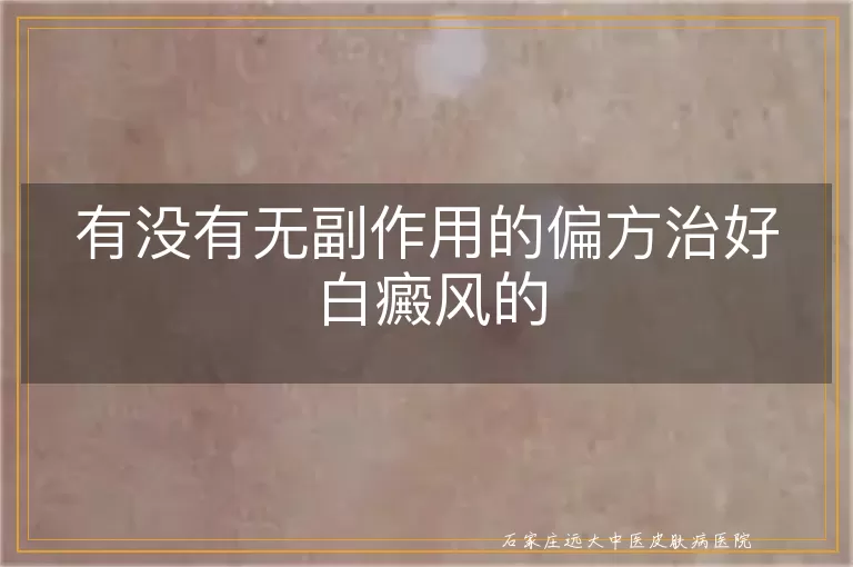 有没有无副作用的偏方治好白癜风的