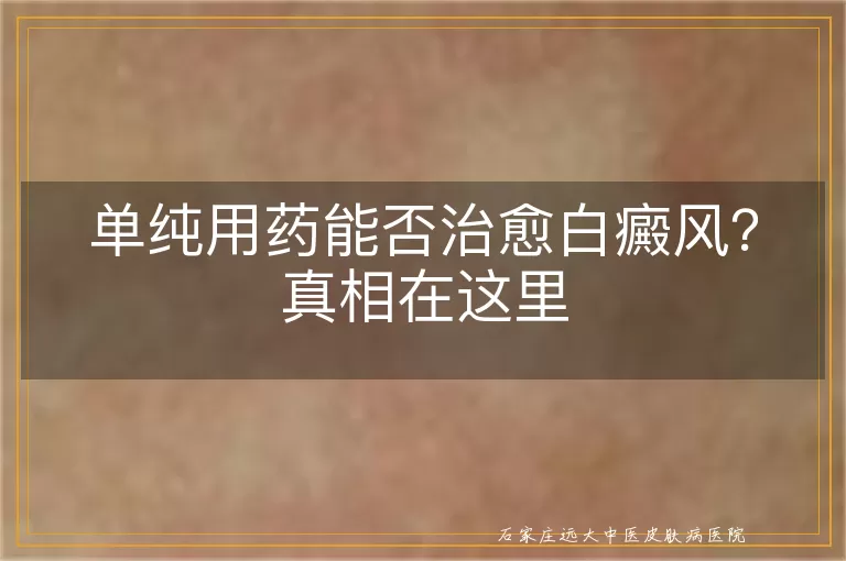 单纯用药能否治愈白癜风？真相在这里