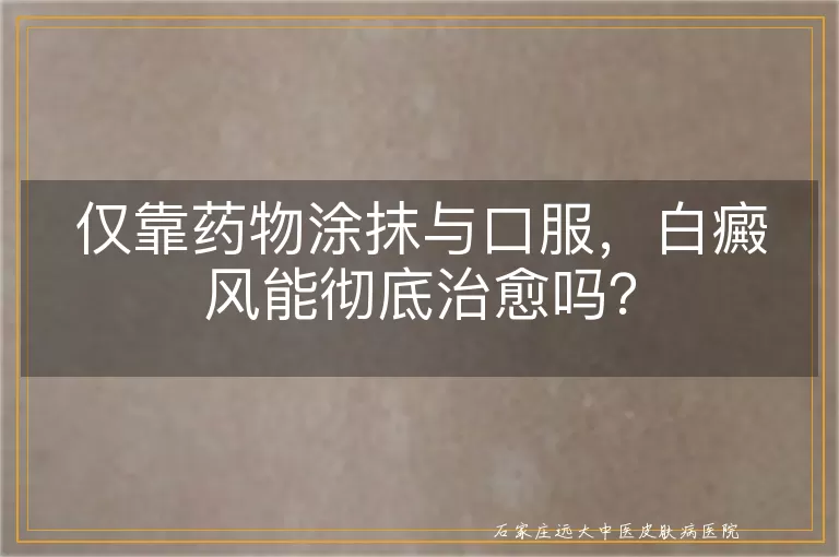 仅靠药物涂抹与口服，白癜风能彻底治愈吗？