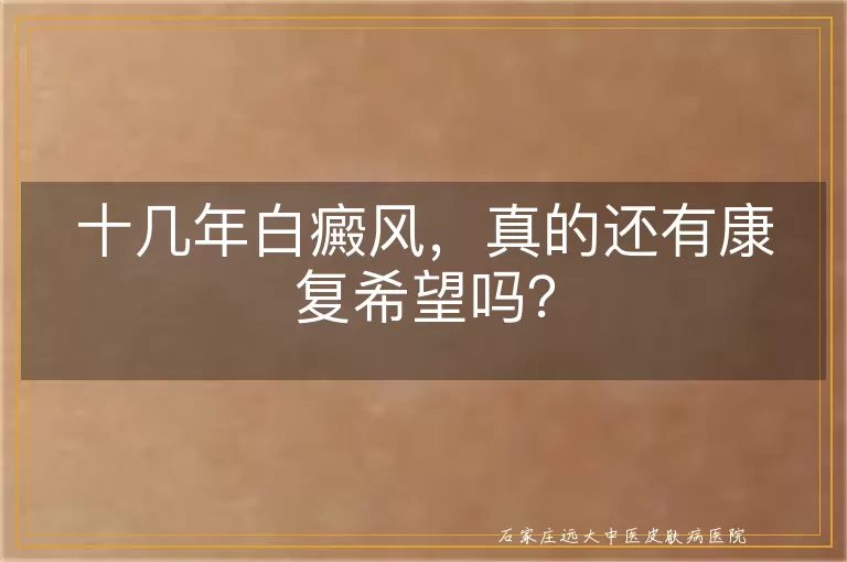 十几年白癜风，真的还有康复希望吗？