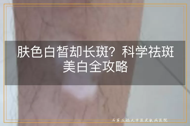 肤色白皙却长斑?科学祛斑美白全攻略