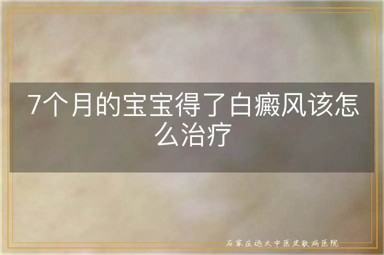 7个月的宝宝得了白癜风该怎么治疗