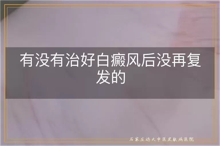 有没有治好白癜风后没再复发的