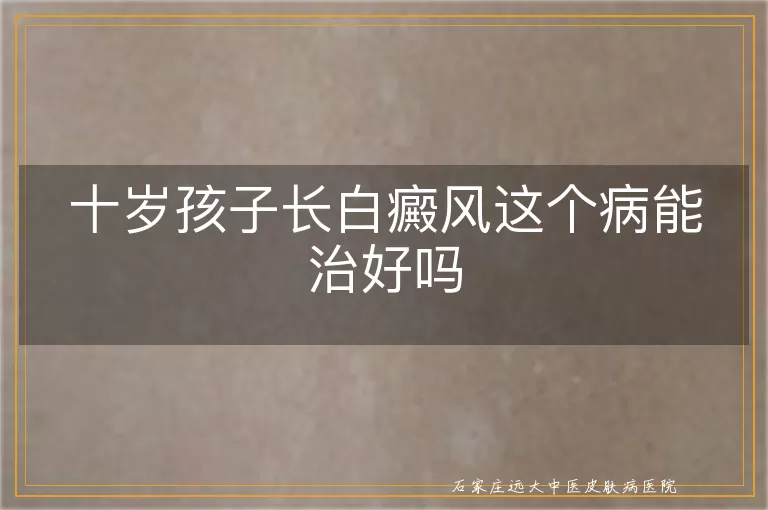 十岁孩子长白癜风这个病能治好吗