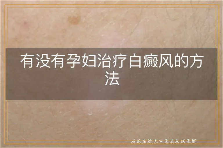 有没有孕妇治疗白癜风的方法