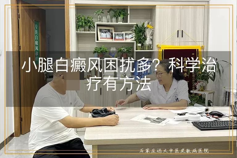 小腿白癜风困扰多？科学治疗有方法