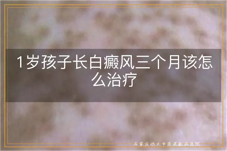 1岁孩子长白癜风三个月该怎么治疗