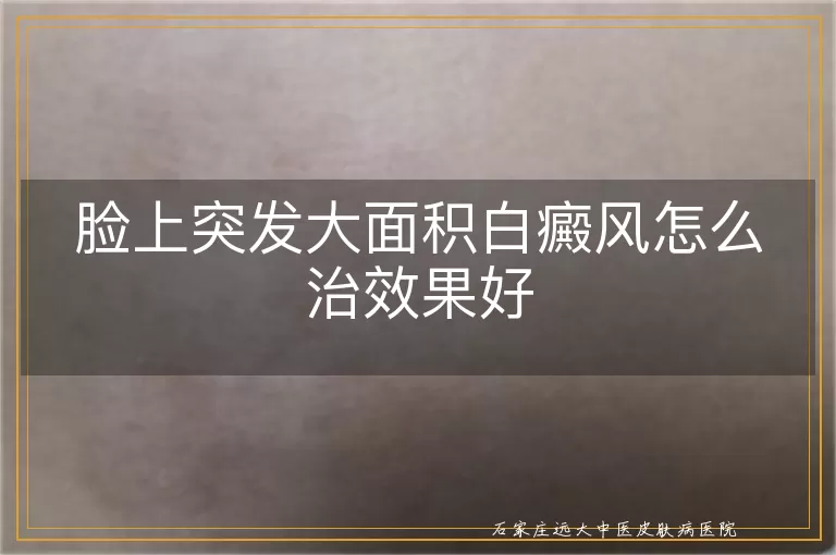 脸上突发大面积白癜风怎么治效果好