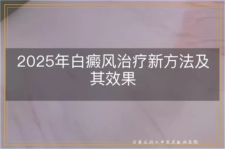 2025年白癜风治疗新方法及其效果