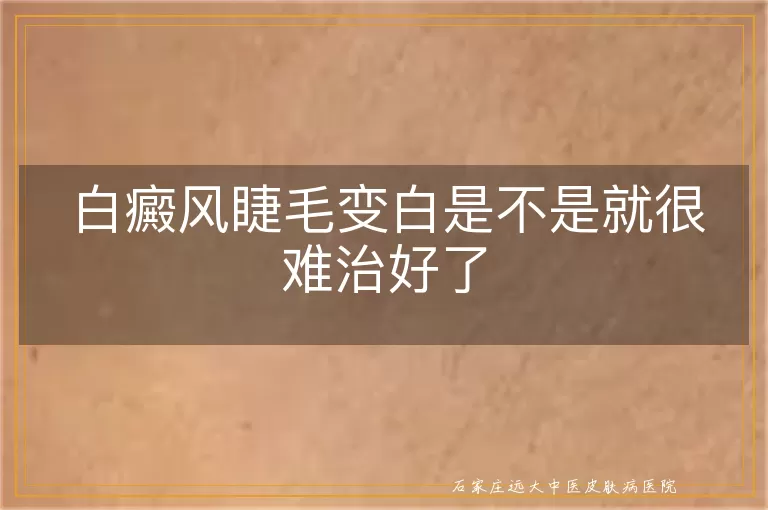 白癜风睫毛变白是不是就很难治好了