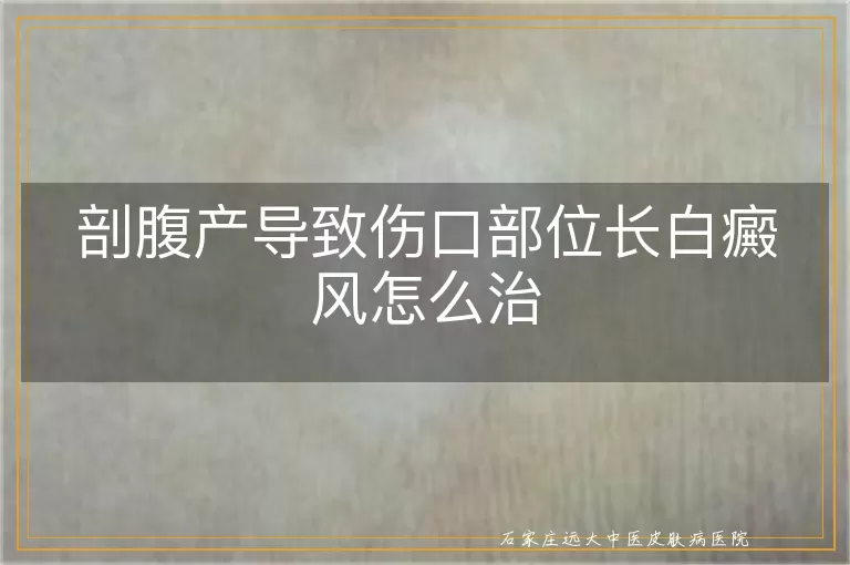 剖腹产导致伤口部位长白癜风怎么治