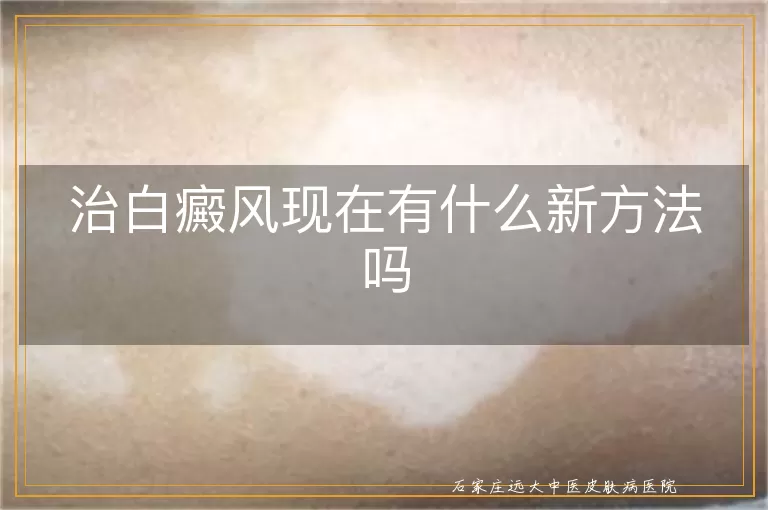 治白癜风现在有什么新方法吗