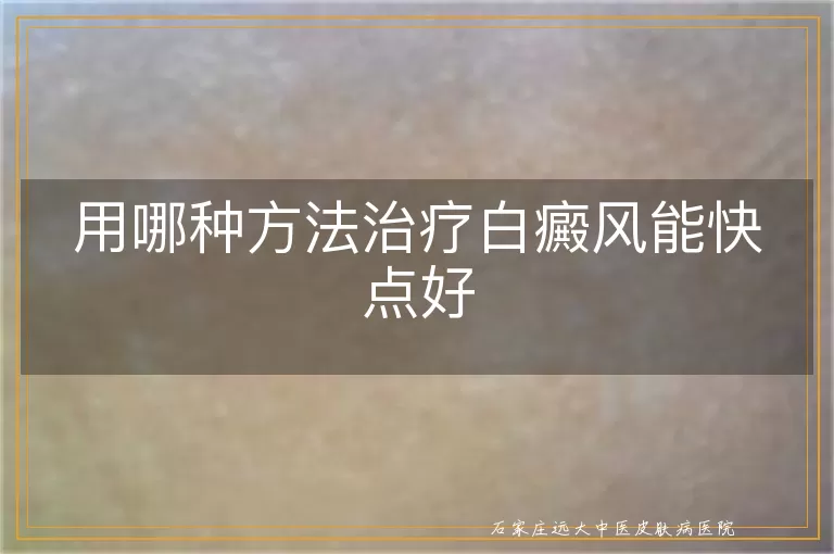 用哪种方法治疗白癜风能快点好