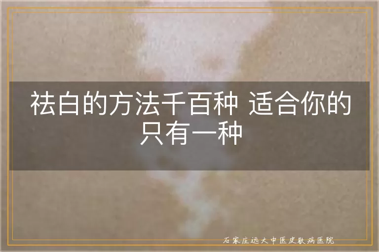 祛白的方法千百种 适合你的只有一种