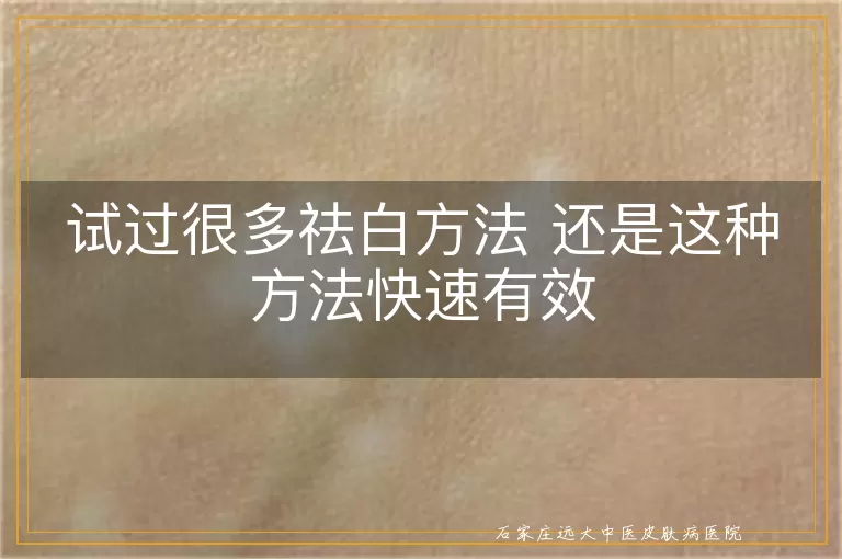 试过很多祛白方法 还是这种方法快速有效