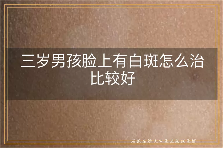 三岁男孩脸上有白斑怎么治比较好