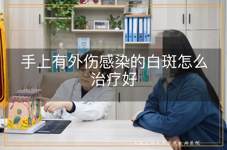 手上有外伤感染的白斑怎么治疗好