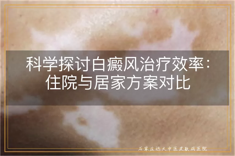 科学探讨白癜风治疗效率：住院与居家方案对比