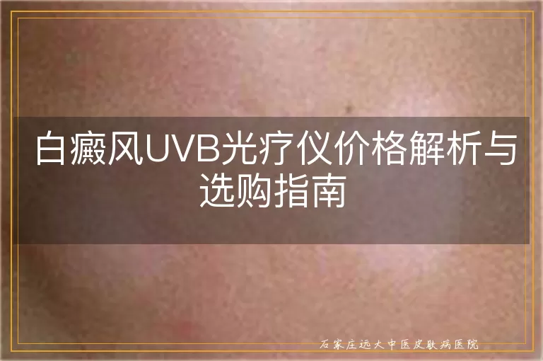 白癜风UVB光疗仪价格解析与选购指南