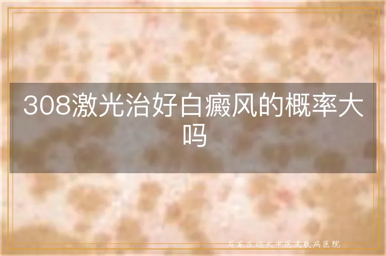 308激光治好白癜风的概率大吗