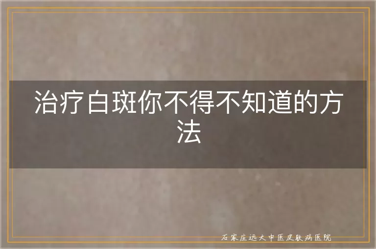 治疗白斑你不得不知道的方法