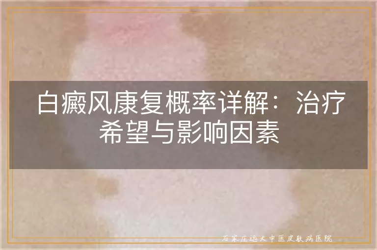 白癜风康复概率详解：治疗希望与影响因素